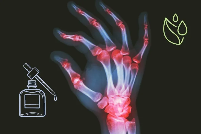 Les huiles essentielles pour soulager les symptômes de l&rsquo;arthrite